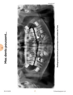 Mes dents